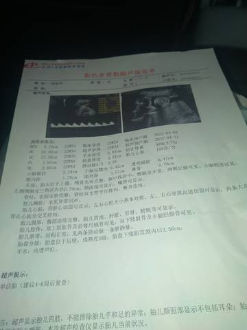 journal_insert_pic_1676063206