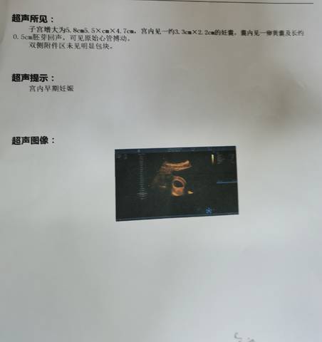 journal_insert_pic_1719541283