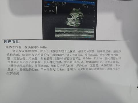 journal_insert_pic_1689677319