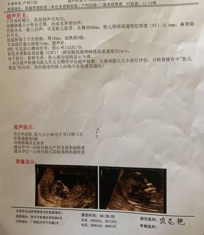 journal_insert_pic_1679160073
