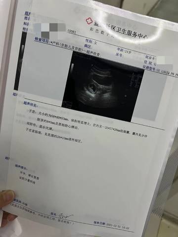 journal_insert_pic_1689580340