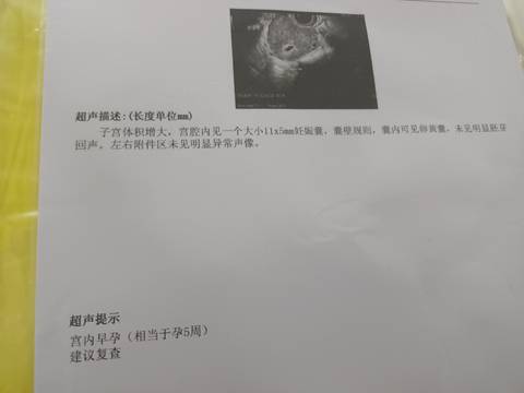 journal_insert_pic_1687266374
