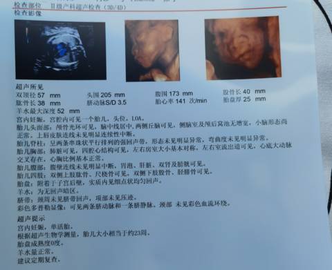 journal_insert_pic_1674728219