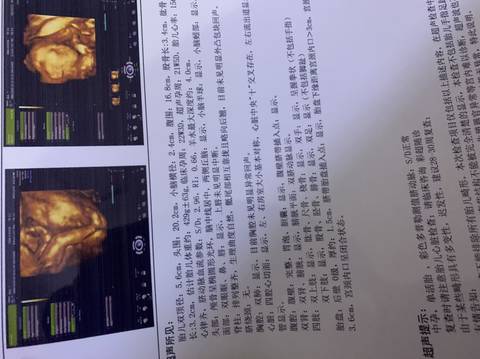 journal_insert_pic_1678006724