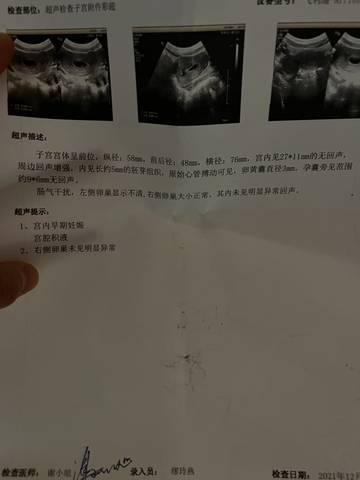 journal_insert_pic_1687380616