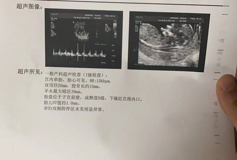 journal_insert_pic_1740989430