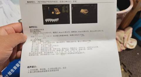 journal_insert_pic_1719441453