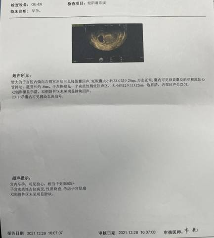 journal_insert_pic_1687798750