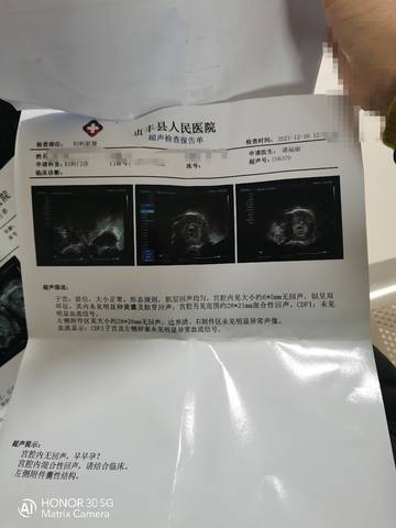 journal_insert_pic_1685755611