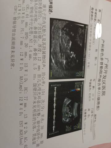 journal_insert_pic_1689045834