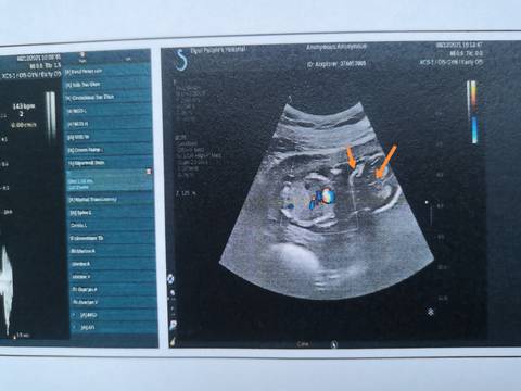 journal_insert_pic_1676552514