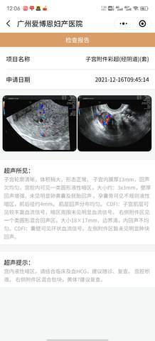 journal_insert_pic_1682432587