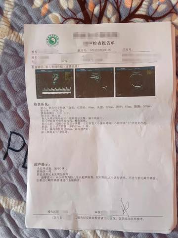 journal_insert_pic_1684221825