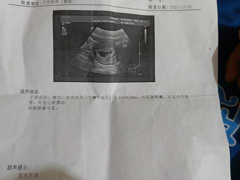 journal_insert_pic_1684247801