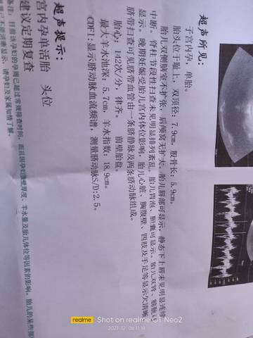 journal_insert_pic_1674709168