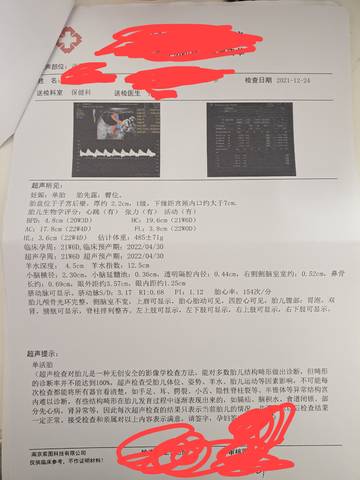 journal_insert_pic_1688675394