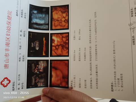 journal_insert_pic_1682457383