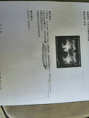 journal_insert_pic_1674661057