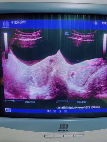 journal_insert_pic_1682964167