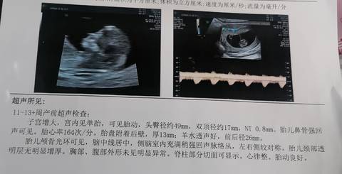 journal_insert_pic_1689601863
