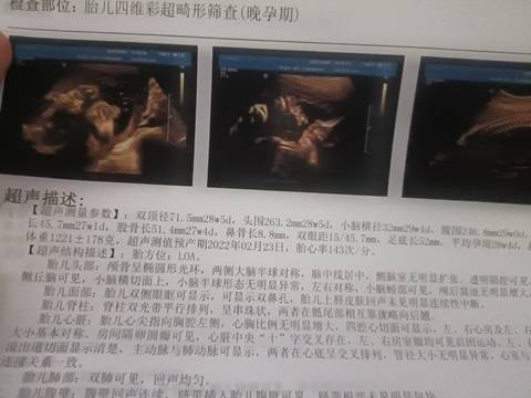 journal_insert_pic_1678162338