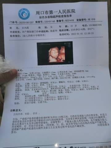 journal_insert_pic_1690480306