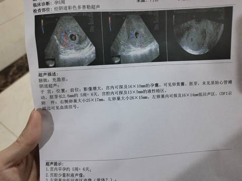 journal_insert_pic_1690295465