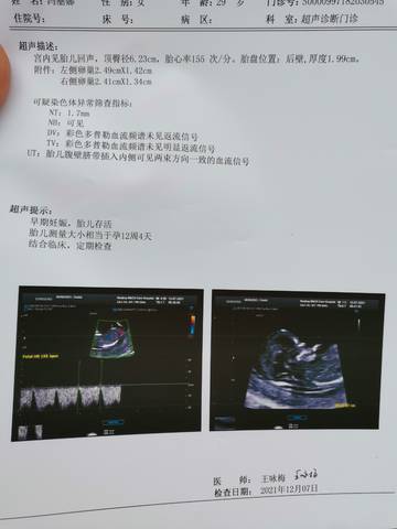 journal_insert_pic_1675301791