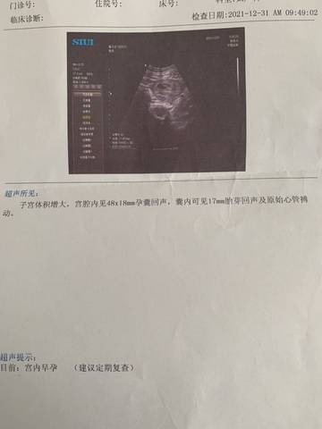 journal_insert_pic_1689660534