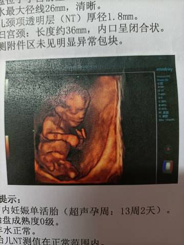 journal_insert_pic_1687487206