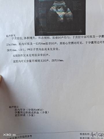 journal_insert_pic_1683130460