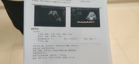 journal_insert_pic_1682614503
