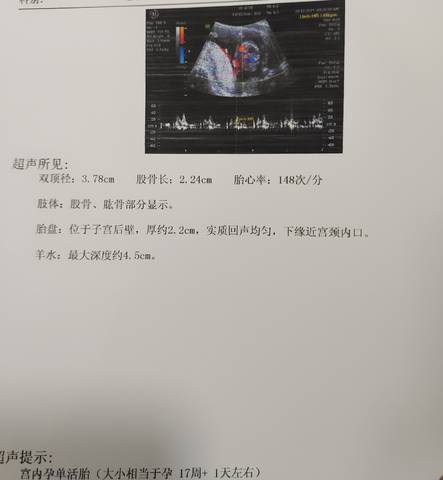 journal_insert_pic_1677990922