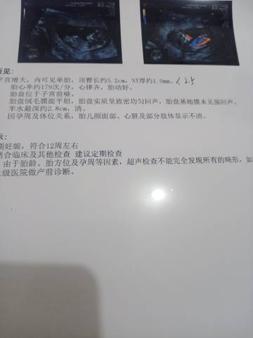 journal_insert_pic_1679957639