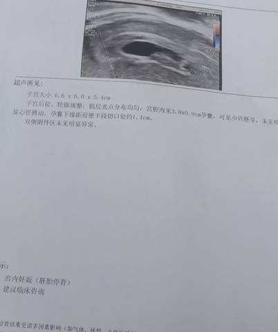 journal_insert_pic_1689715586