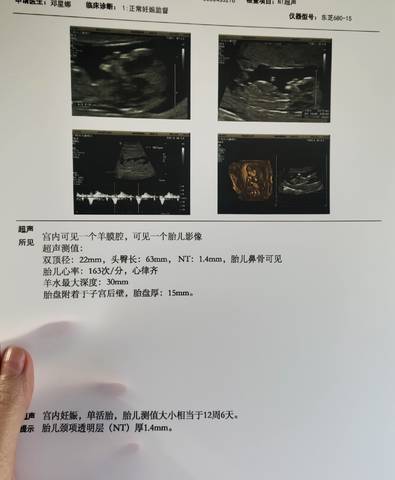 journal_insert_pic_1684184313