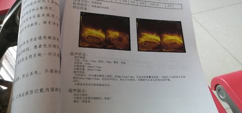 journal_insert_pic_1675445426