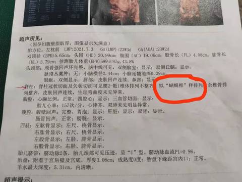 journal_insert_pic_1683164137