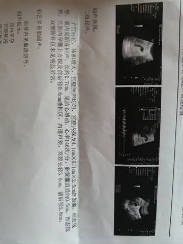 journal_insert_pic_1682574525