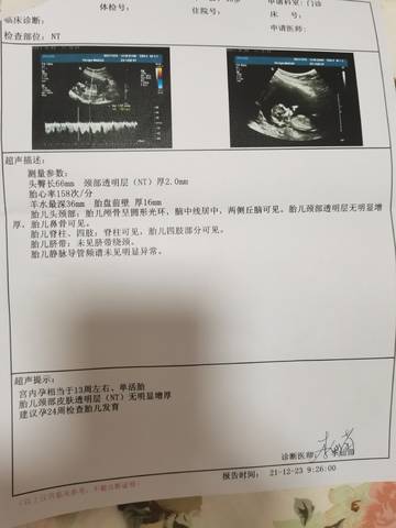 journal_insert_pic_1685122701