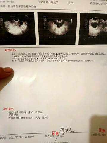 journal_insert_pic_1678903292