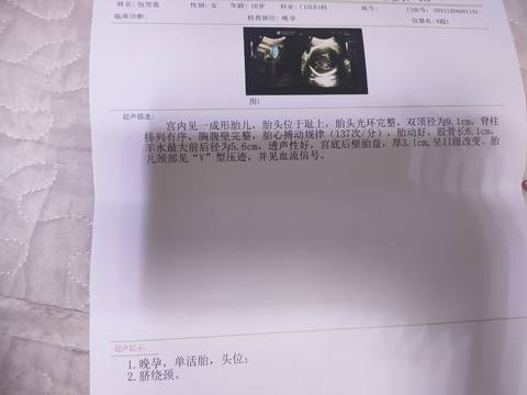 journal_insert_pic_1679869022