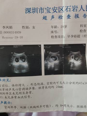 journal_insert_pic_1677326180