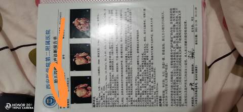 journal_insert_pic_1682308644