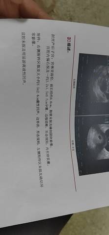 journal_insert_pic_1678153468