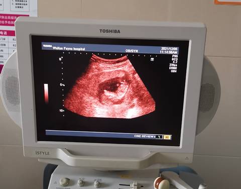 journal_insert_pic_1674598940