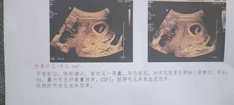 journal_insert_pic_1674010365