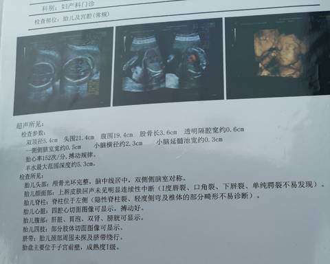 journal_insert_pic_1681340249