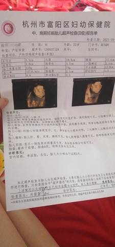 journal_insert_pic_1689321682
