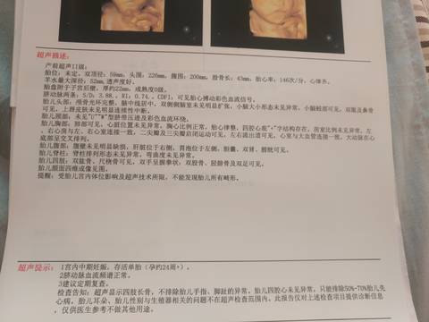 journal_insert_pic_1674201227